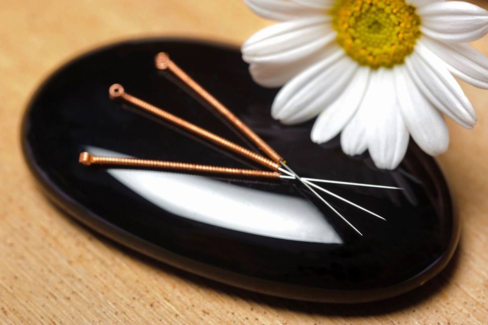 Acupuncture needles and flower